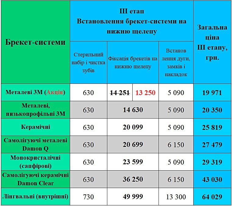 Встановлення брекет-системи ціна Київ ЛюміДент
